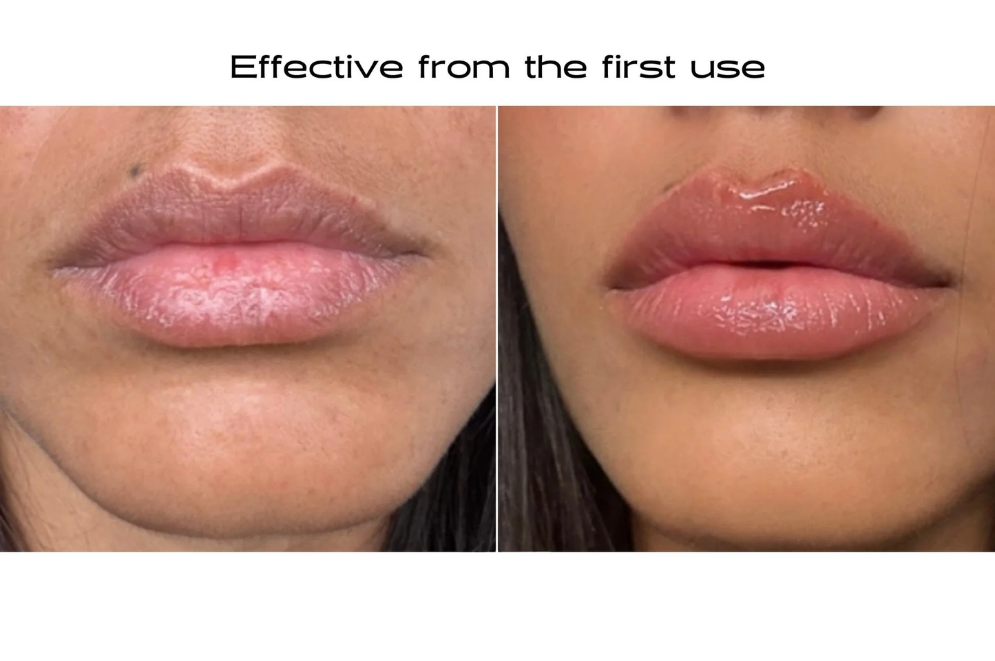 Plumping Microneedling Lip Patches