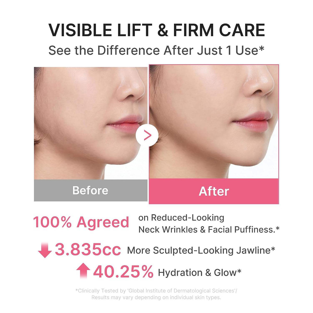 PDRN Collagen Gua Sha Neck Wrinkle Cream with Volufiline 5%